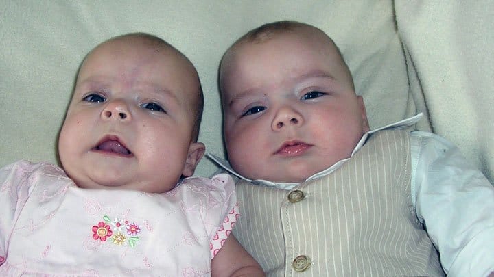Fraternal boy-girl babies