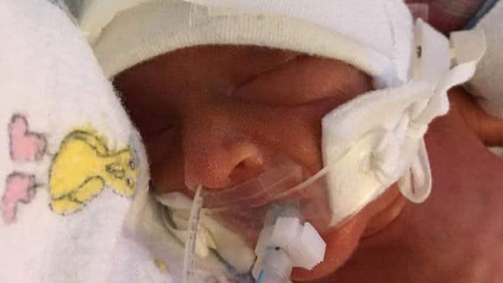 twins born at 28 weeks