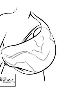 Wrong way of carrying baby in sling